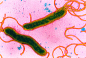 TEM of Helicobacter pylori bacteria
