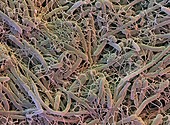 Soil bacteria,SEM