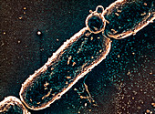 Anthrax bacteria,SEM