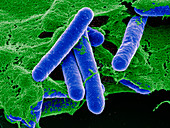 Clostridium botulinum bacteria