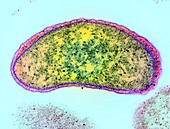 Vibrio cholerae bacterium,TEM