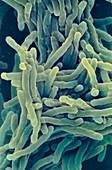 Tuberculosis bacteria,SEM