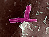 Bacteria infecting a macrophage,SEM