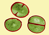Staphylococcus aureus dividing,TEM