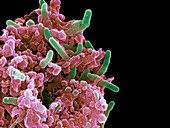 Bacteria infecting a macrophage,SEM