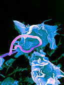 Bacteria infecting a macrophage,SEM