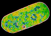 Clostridium perfringens bacterium,TEM