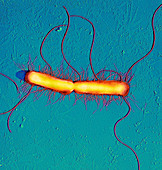 Proteus vulgaris bacteria,SEM
