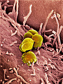 Gonorrhoea bacteria,SEM