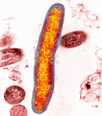 Mycobacterium bacteria,TEM