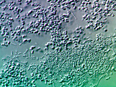 Bacterial biofilm,light micrograph