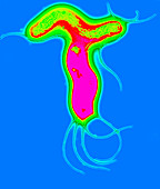 Helicobacter pylori bacteria,TEM