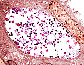 Chlamydia trachomatis bacteria,TEM