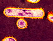 Lactobacillus casei Shirota bacteria