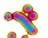 Porphyromonas oral bacteria,TEM