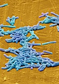 Clostridium difficile bacteria,SEM