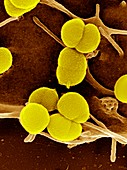 Gonorrhoea bacteria,SEM
