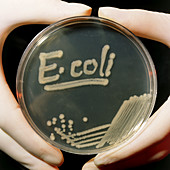 Petri dish culture of E.coli bacteria