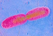 F/col shadow TEM of E. coli dividing