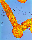 Col TEM of E.coli treated with penicillin