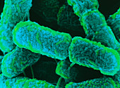 SEM of Escherichia coli bacteria