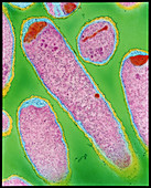 E. coli 0157:H7 bacteria