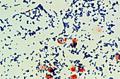 Staphylococcus epidermidis bacteria