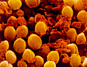 Antibiotic action on Staphylococcus