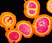 MRSA resistant Staphylococcus bacteria