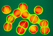Staphylococcus aureus bacteria dividing