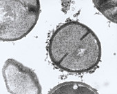 TEM of Staphylococcus aureus bacteria