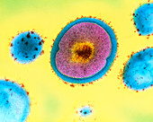 Single Staphylococcus aureus bacterium