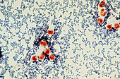 LM Streptococcus pneumoniae