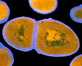 F/col TEM of Enterococcus faecalis