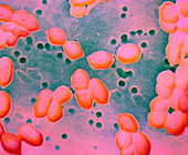 Streptococcus pneumoniae bacteria