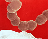 Streptococcus mutans bacteria on tooth