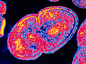 Coloured TEM of Enterococcus faecalis