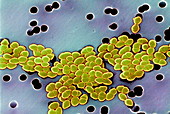 Drug-resistant bacteria,SEM