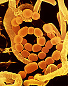 SEM of soil bacteria