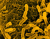 Plant cancer bacteria,Agrobacterium