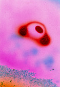 Mycoplasma pneumoniae bacteria