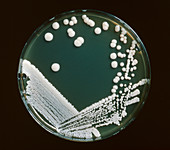 Petri dish culture,Torulopsus glabrata
