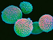 SEM of cryptococcus fungi
