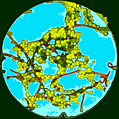 Candida albicans fungus,TEM
