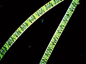 Two filaments of green alga,Spirogyra