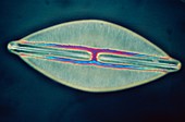 LM of a diatom alga,Navicula lyra