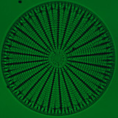 Wheel-shaped diatom,Arachnoidiscus
