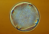Marine diatom,Aulacodiscus