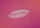 LM of the marine diatom Navicula lyra