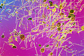 LM of different species of diatoms